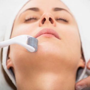 Face Microneedling Treatment With A Meso Roller.